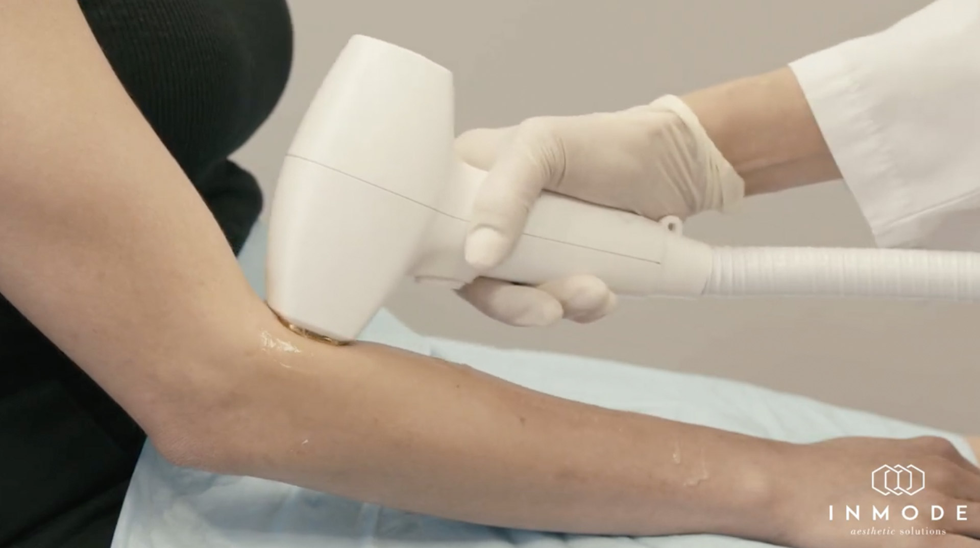 HairRemoval_04